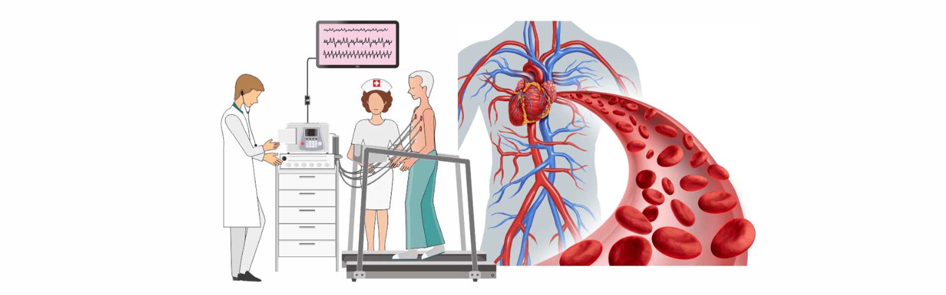 Myocardial Infusion Scan TMT Stress-Instructions Treatment in Goa