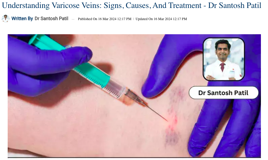Dr. Santosh Patil explores varicose veins