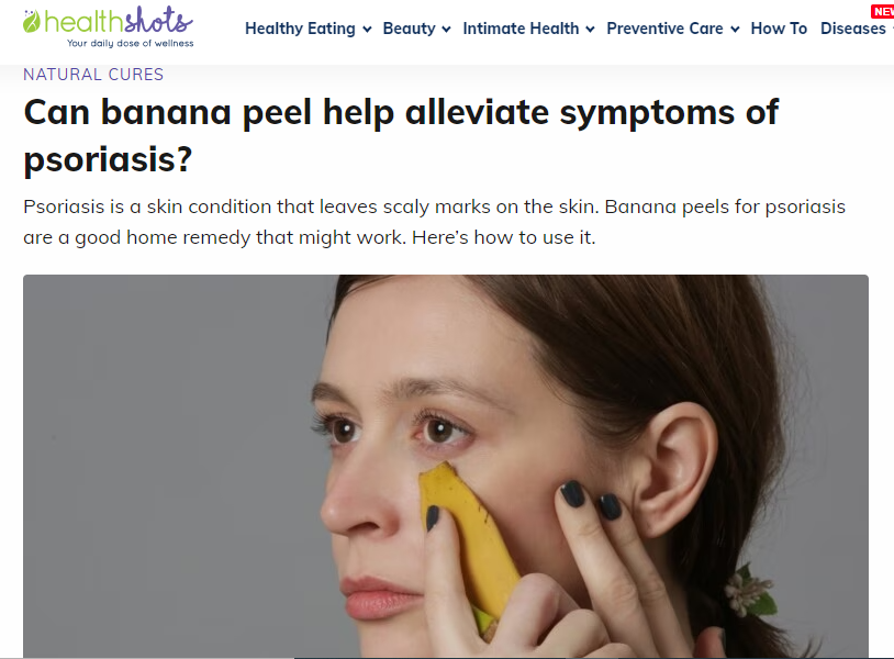 Banana peel help alleviate symptoms of psoriasis