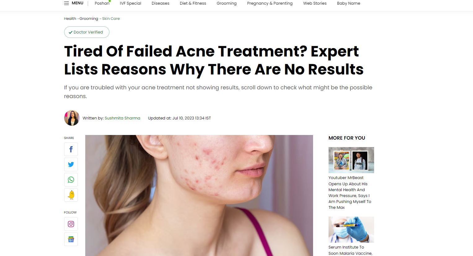 Failed Acne Treatment