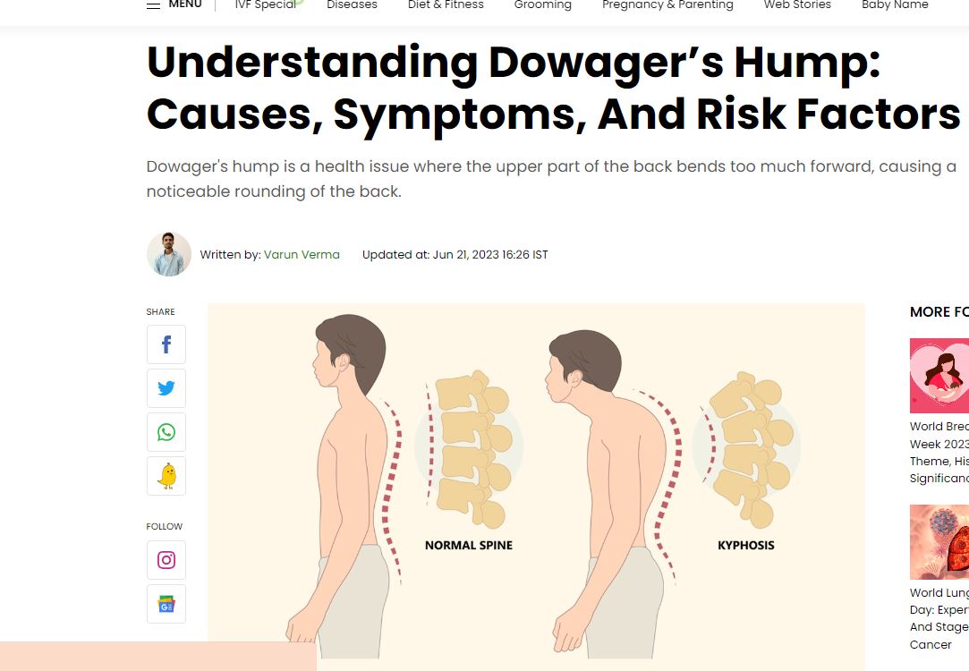 Understanding Dowager’s Hump