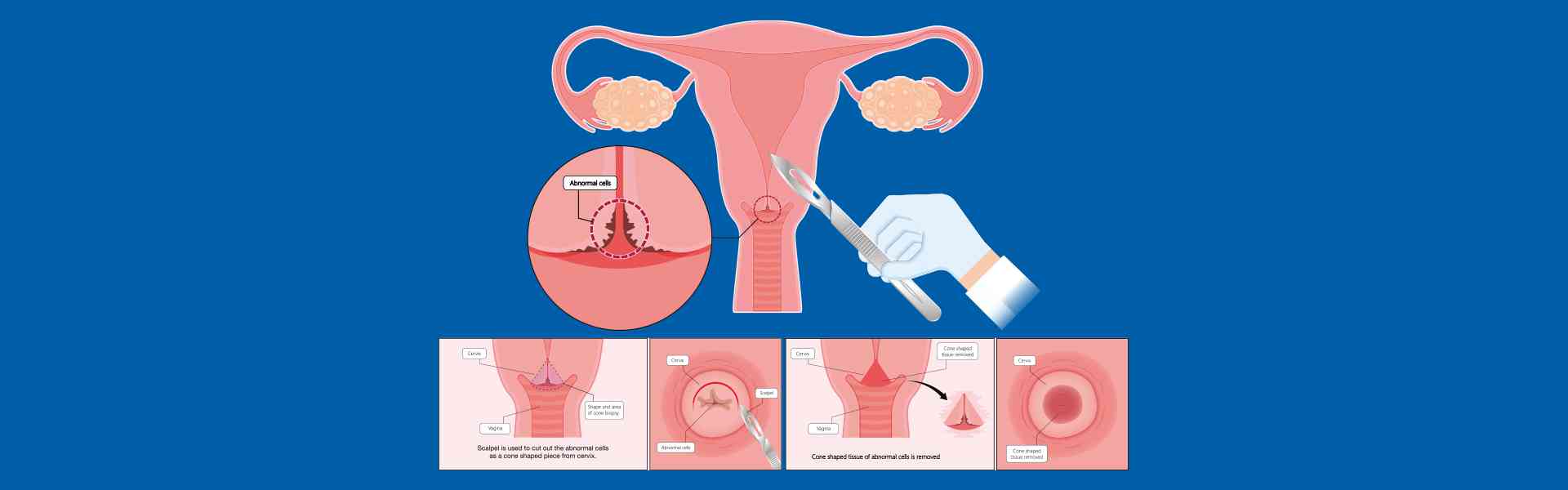 Top Pap Smear Hospitals in millers road