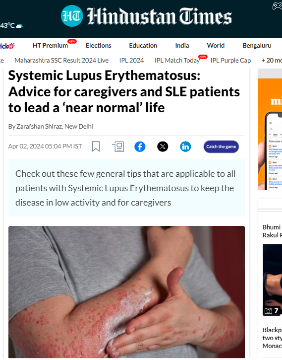  Systemic Lupus Erythematosus: 