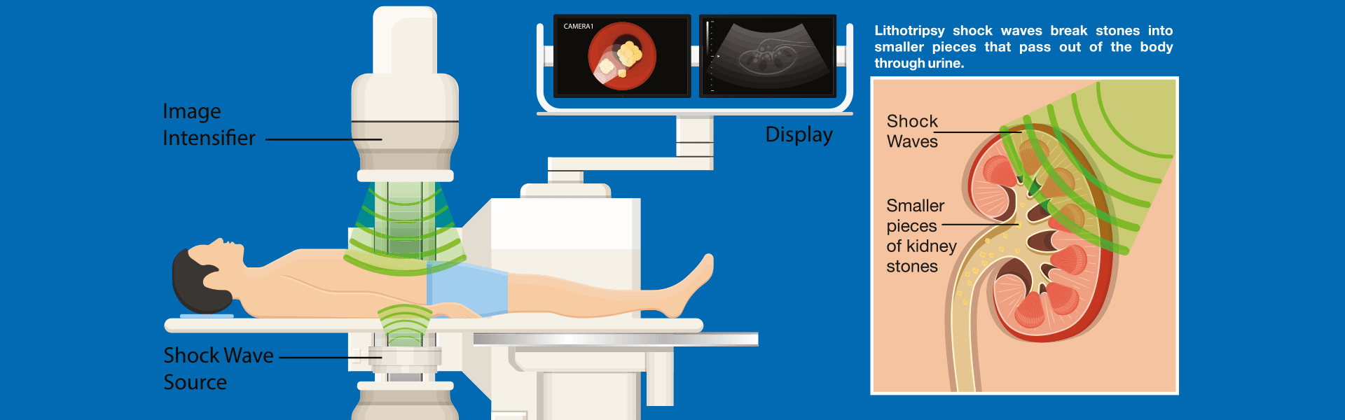 Urology Hospital in Salem | Urologist in Salem