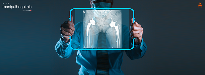 Advanced Techniques in Total Hip Replacement