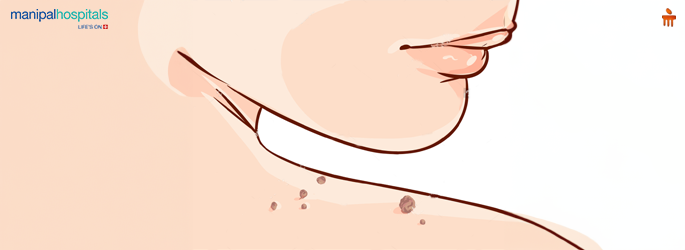 Effective Mole & Skin Tag Removal: Best Treatment Options