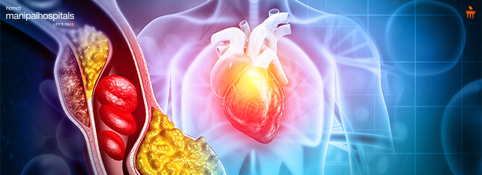 Heart block types and treatment