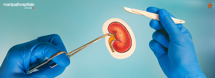 Pros and Cons of Renal Transplantation