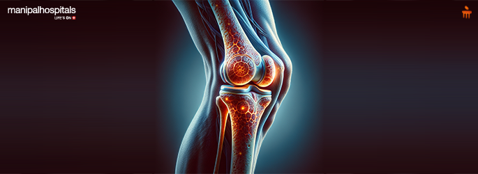 How to Prevent Arthritis