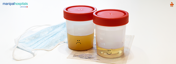 Cloudy Urine: Causes, Symptoms and Treatment