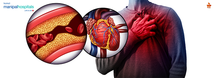 best cardiologists in Dwarka, Delhi