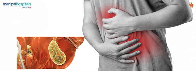 Gallstones Treatment-Symptoms, Causes, and Surgery Options