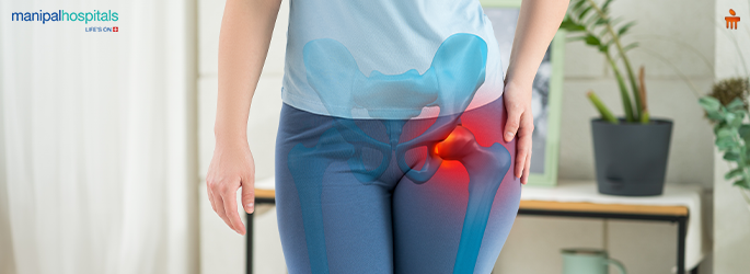 Hip Fracture (Broken Hip): Symptoms, Risks & Recovery