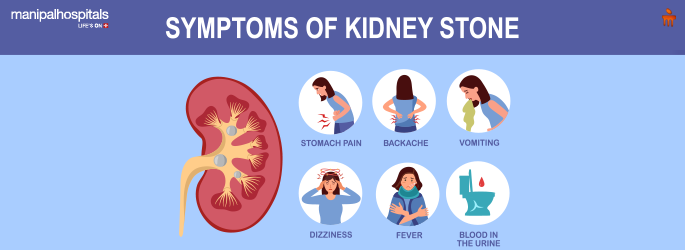 Kidney Stone Surgery: Removal Options