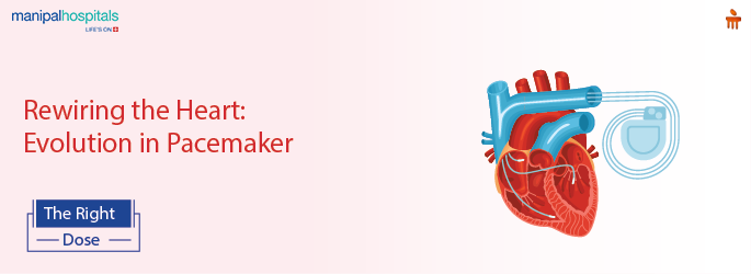 cardiac pacemaker