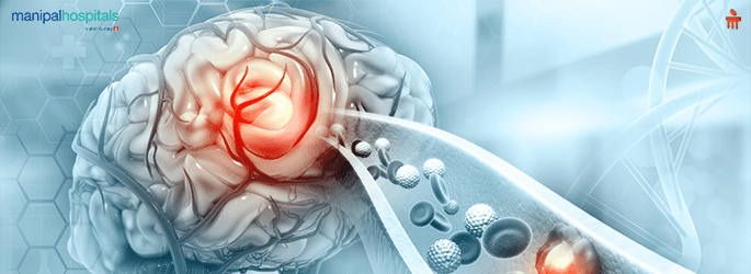 Blood Clot, Symptoms and its Causes 