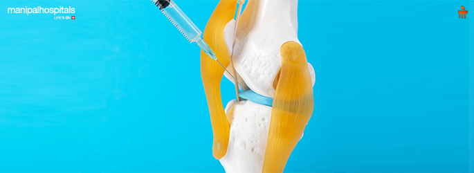 Top 5 Benefits of Intra-Articular Injections for Joint Pain