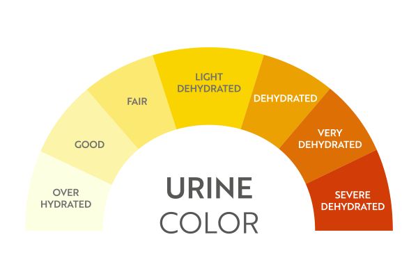 Cloudy Urine: Causes, Symptoms and Treatment