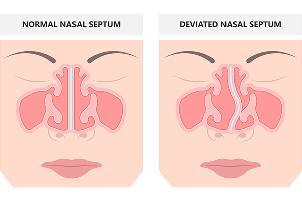 mouth taping benefits