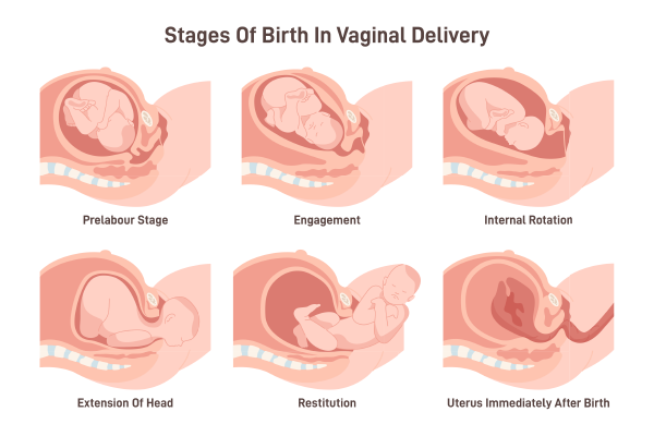 Preparing for Normal Delivery