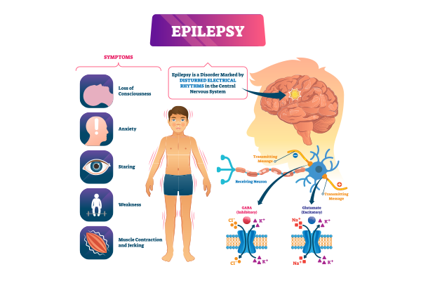 Understanding Epilepsy: Comprehensive Guide to Seizures, Management, and Support