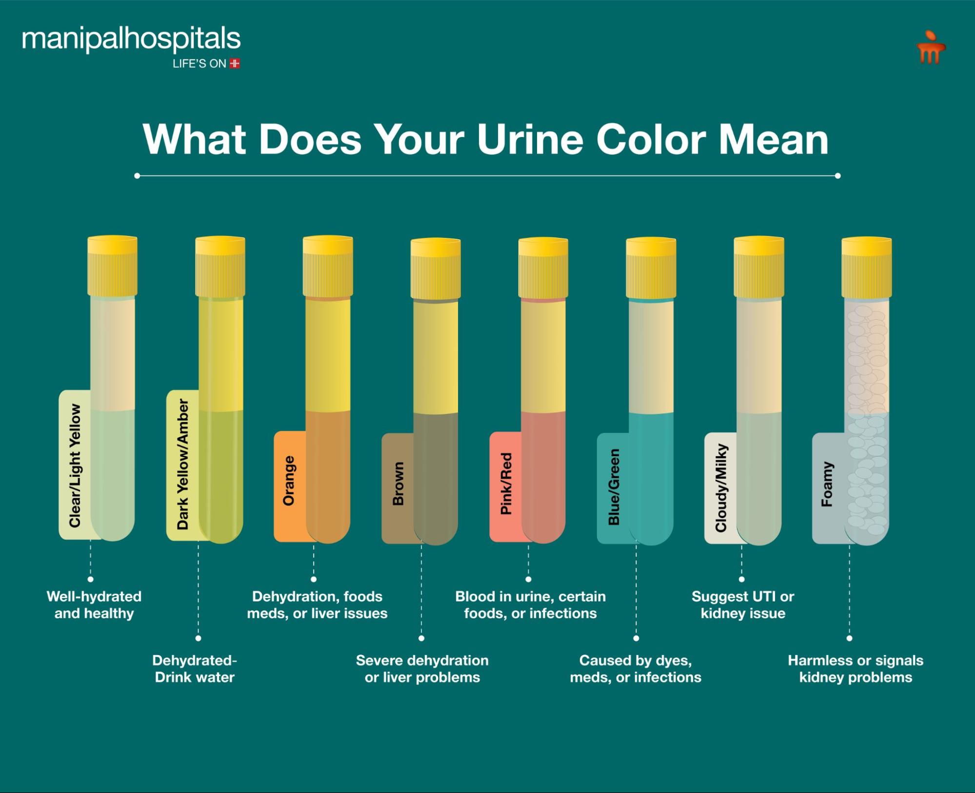 What does your urine color mean