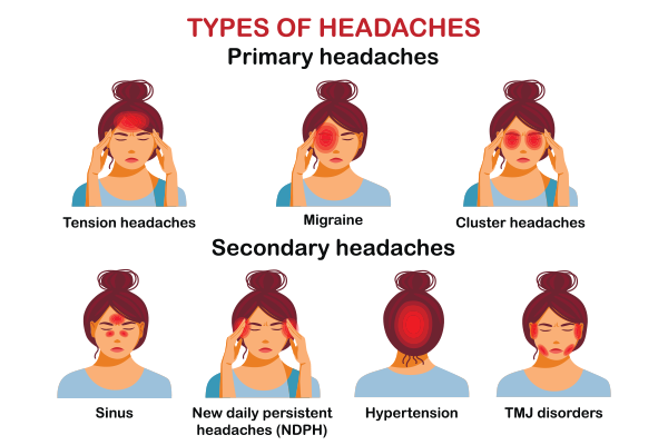 Headache causes