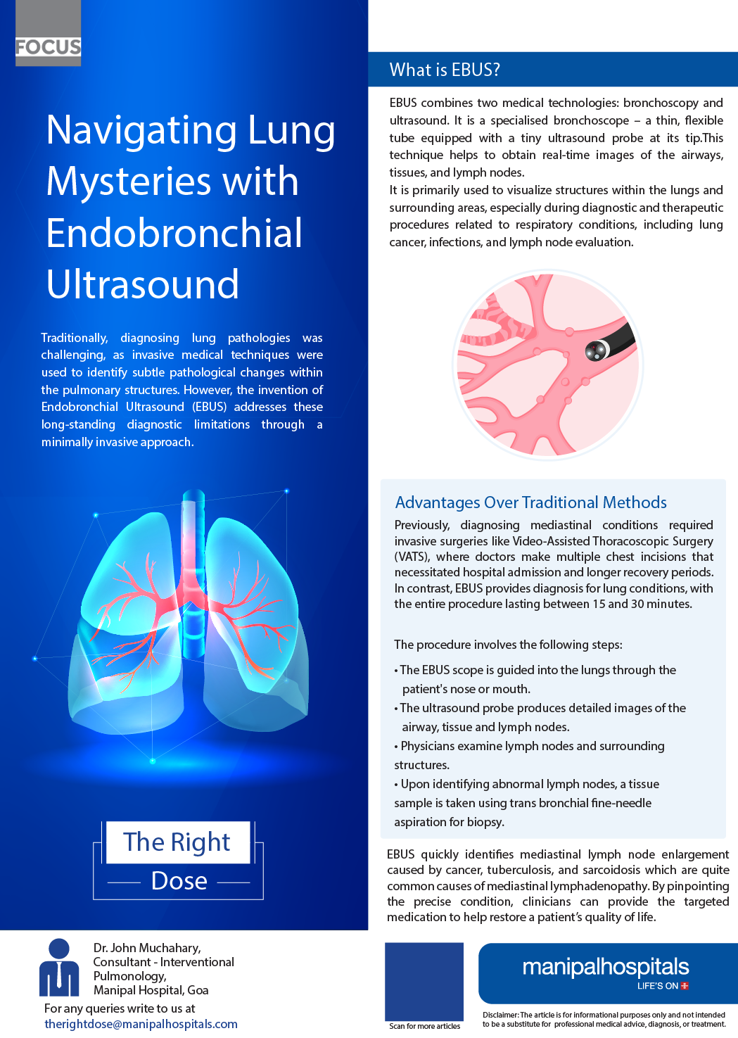 Endobronchial Ultrasound Advantages