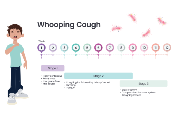 Whooping Cough (Pertussis): Causes, Symptoms & Prevention