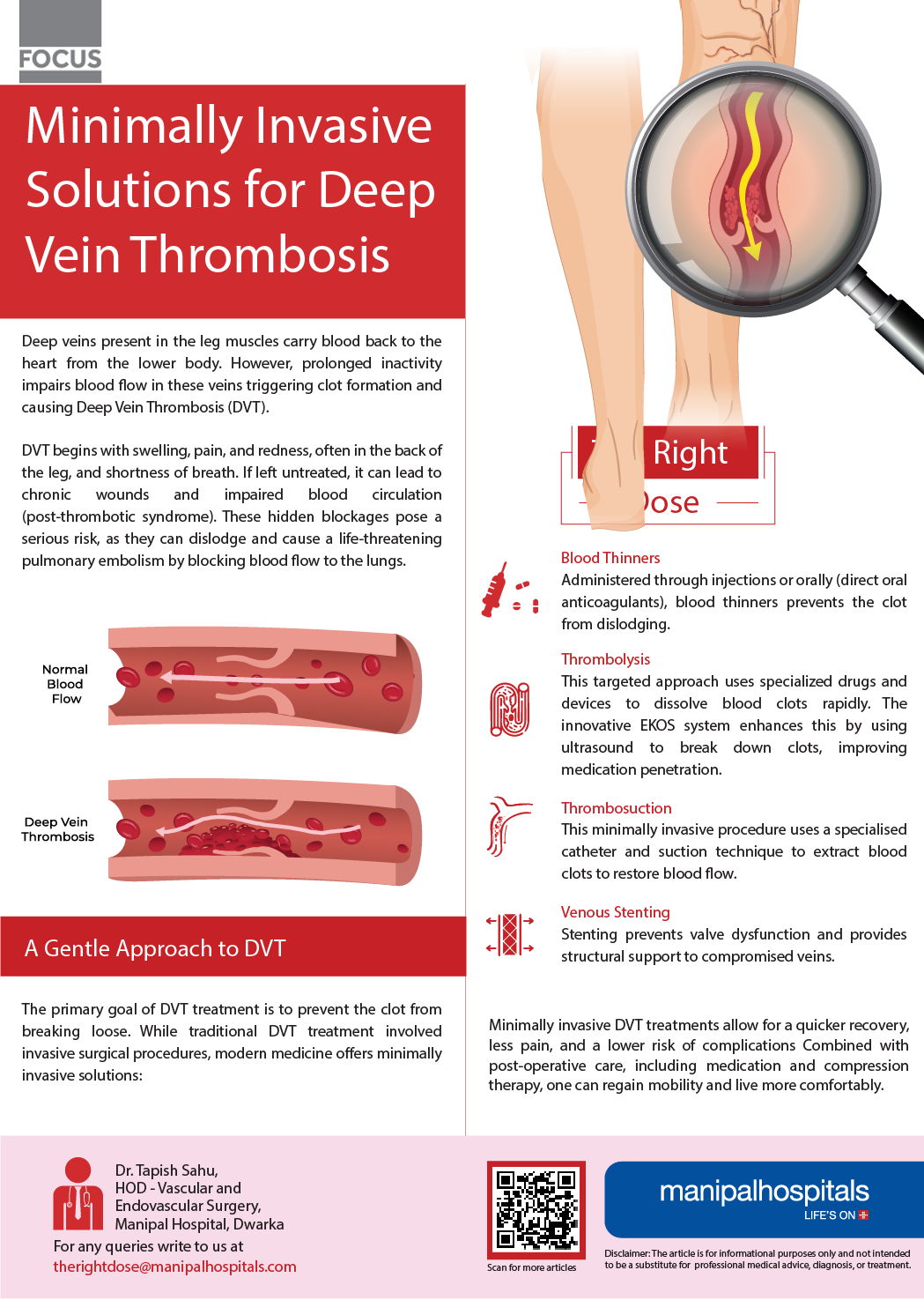 Causes of Deep Vein Thrombosis