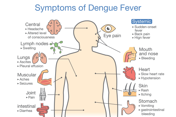 Symptoms of Dengue Fever