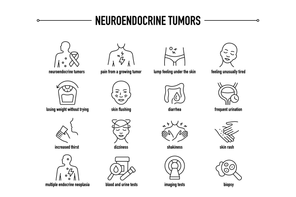 early-detection-of-neuroendocrine-tumors