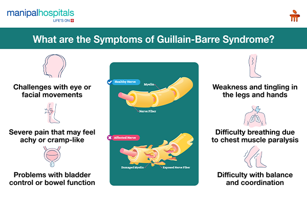 Symptoms of Guillain-Barre Syndrome