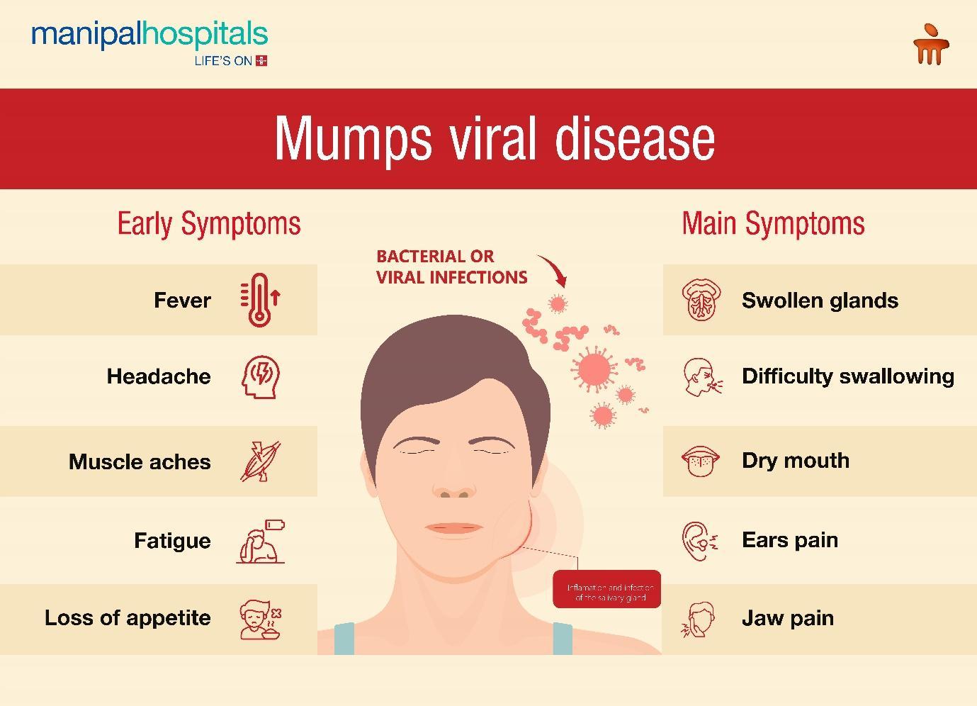 Mumps viral disease