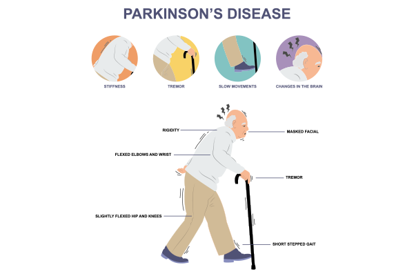 Causes and Risk Factors of Parkinson's Disease