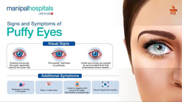 Signs and symptoms of puff eyes
