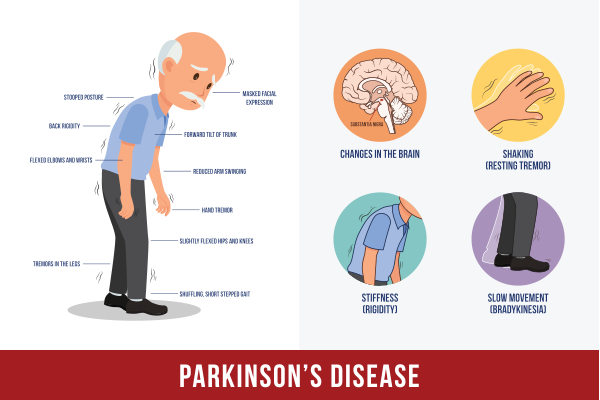 Early Signs of Parkinson's Disease