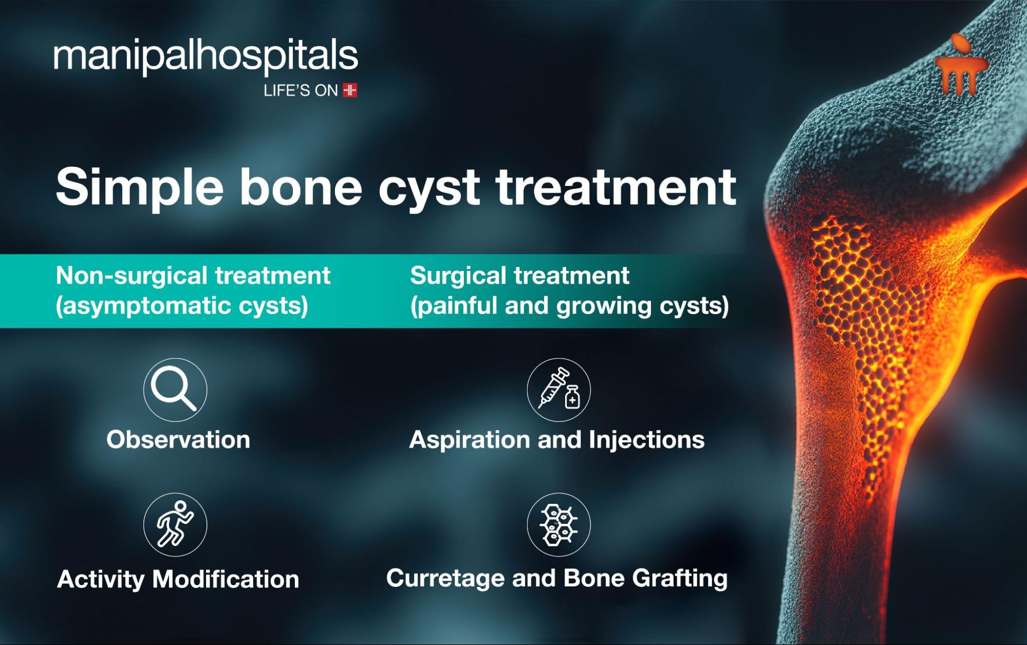 Simple Bone Cyst Treatment