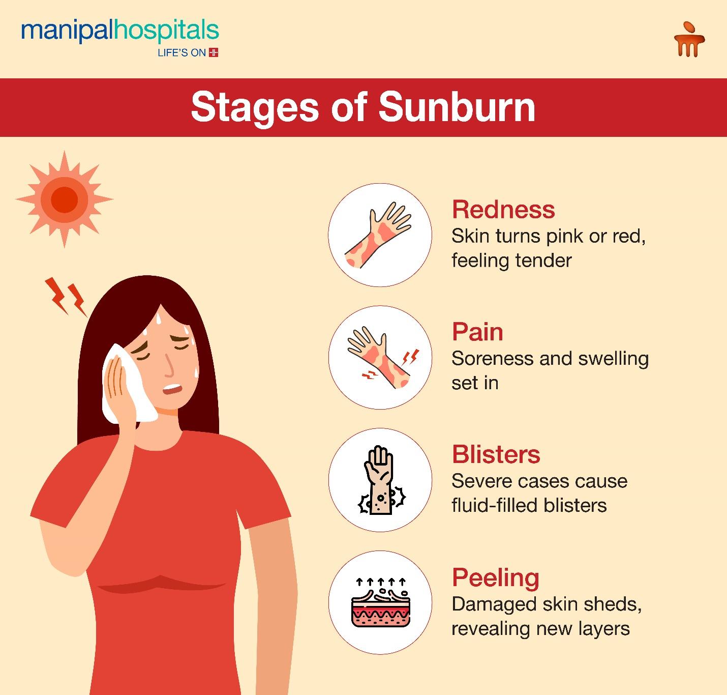 stages-of-sunburn