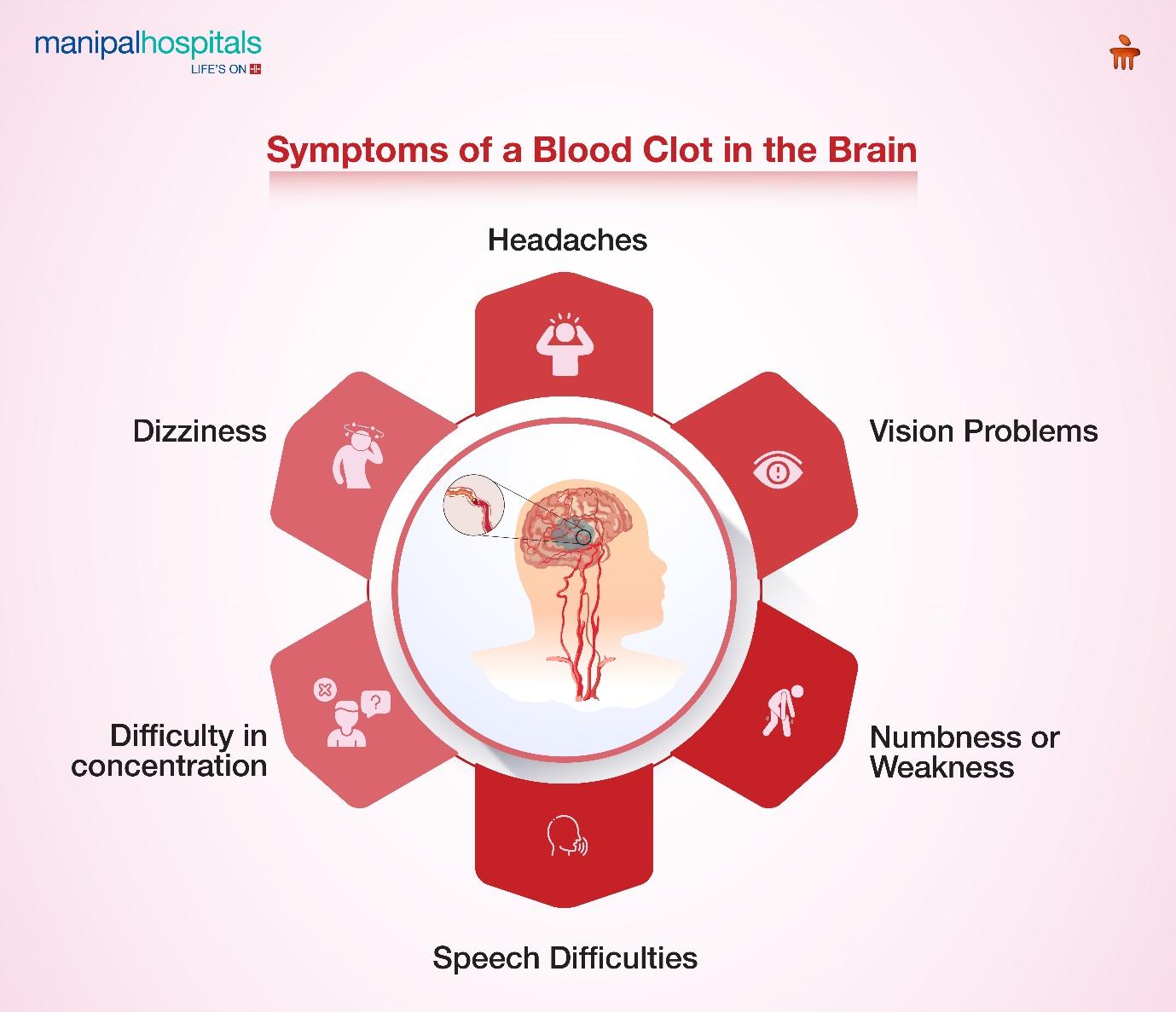 What are the Signs and Symptoms of Blood Clots in the Brain?