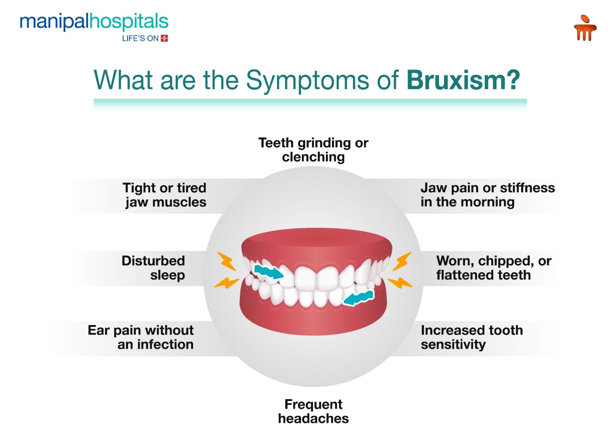 Symptoms of Bruxism