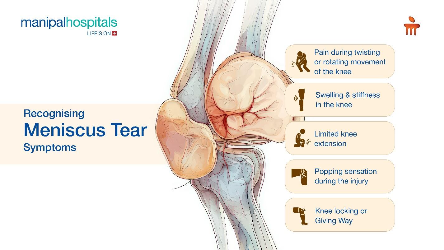 Symptoms of Meniscus Tears