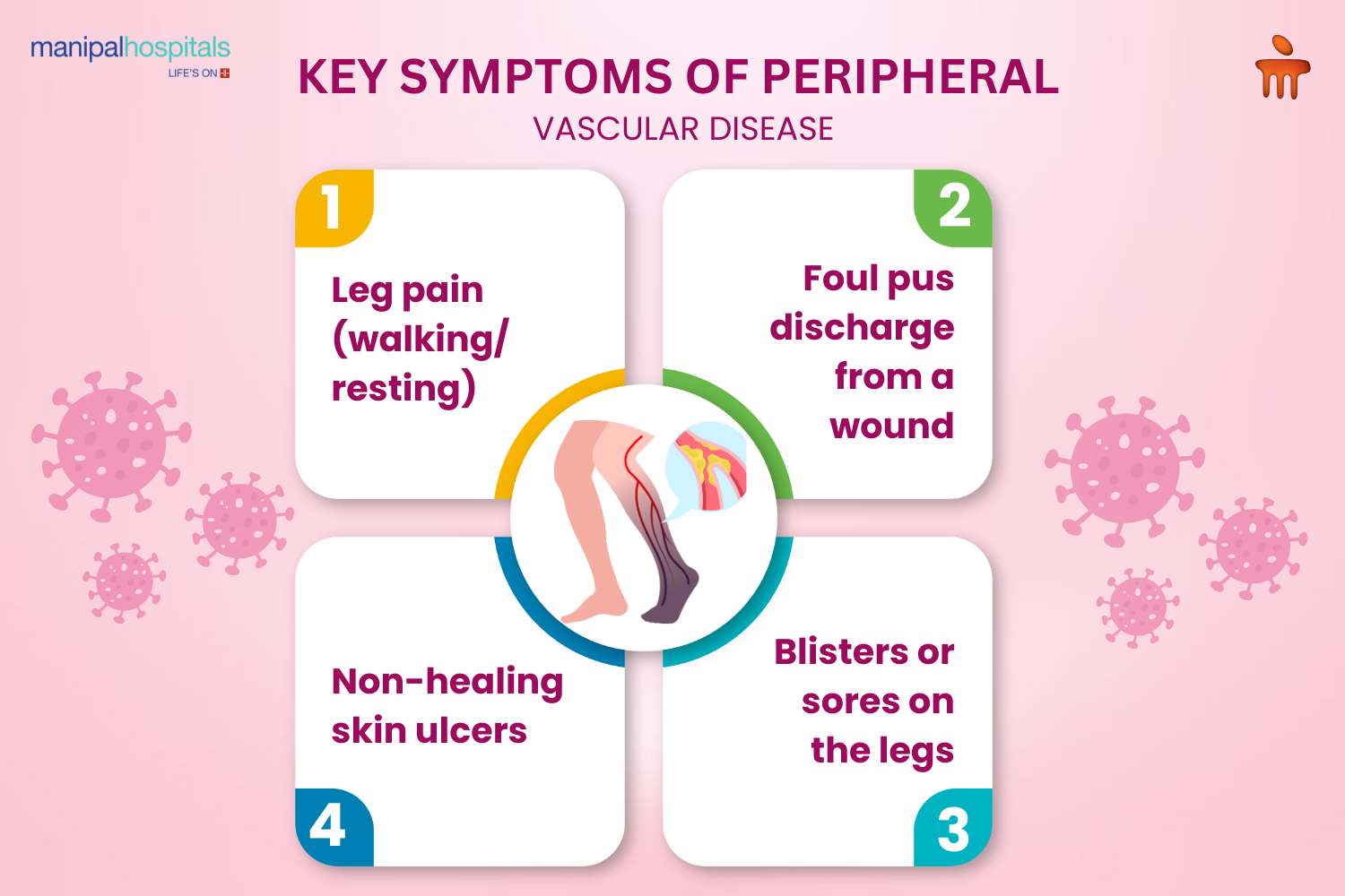 Symptoms of Peripheral Arterial Disease 