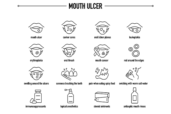 tongue ulcer treatment