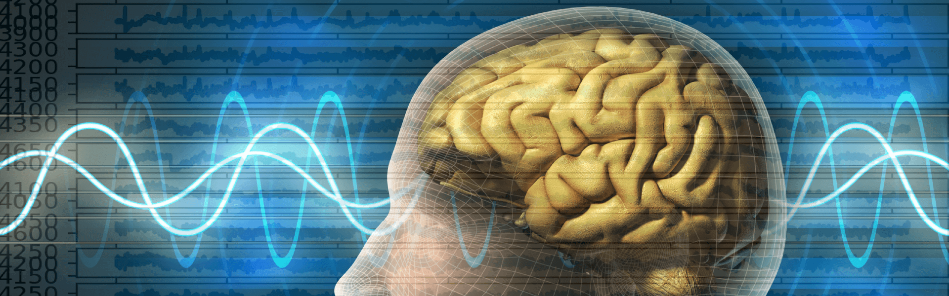 EEG - Electroencephalogram