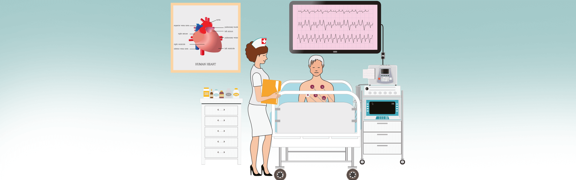 ECG