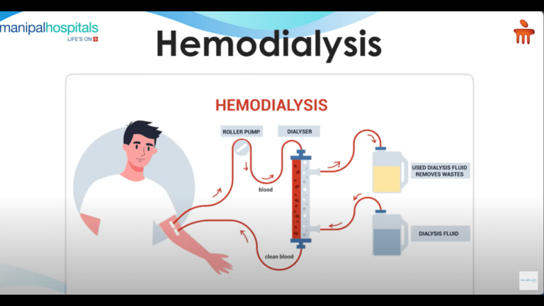 hemodialysis-hospital-in-varthur-road-bangalore.png