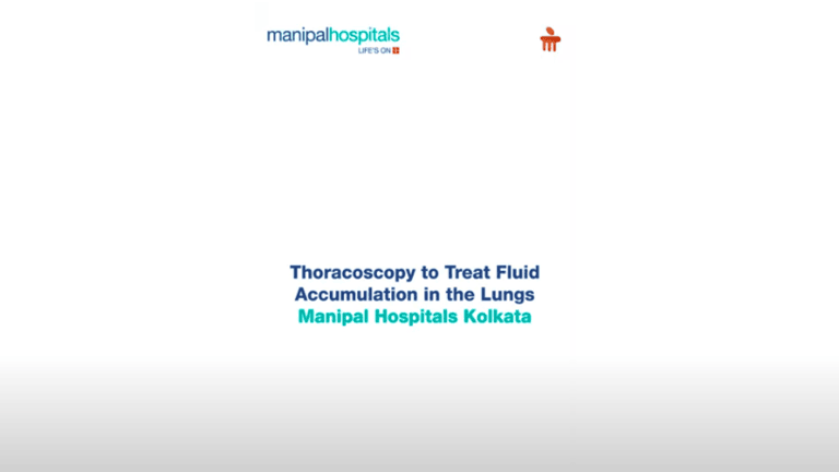 thoracoscopy-to-treat-fluid-accumulation-in-lungs_(1).png