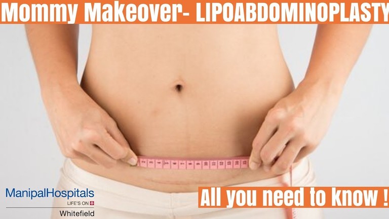 what-is-lipoabdominoplasty-or-tummy-tuck_768x432.jpg