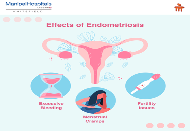 Best Hospital in Whitefield Bangalore near Hoodi | Manipal Hospitals